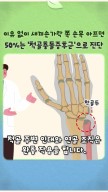 이유 없이 새끼손가락 쪽 손목 아프면 50%는 ‘척골충돌증후군’으로 진단