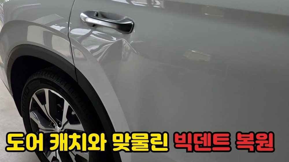 네이버 인플루언서: 서울최고덴트집의 홈 [네이버 인플루언서] 서울최고덴트집