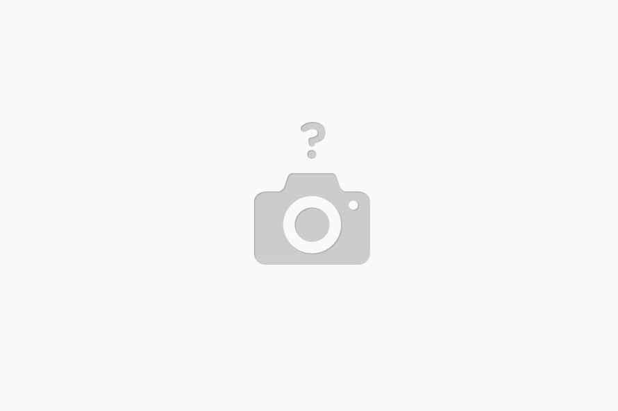 참좋은안과의원 이미지