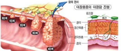 참건강나라 이미지