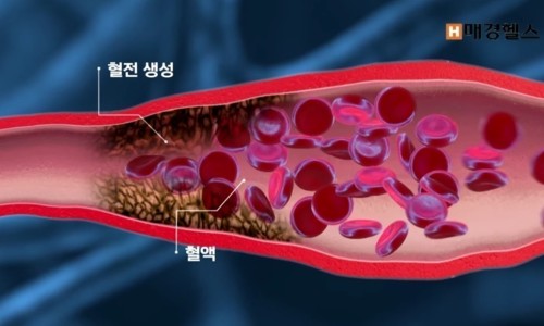 오혜숙생활단식채비지사 이미지