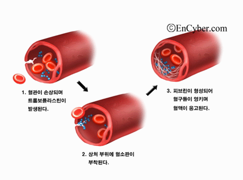 혈액응고 : 네이버 블로그