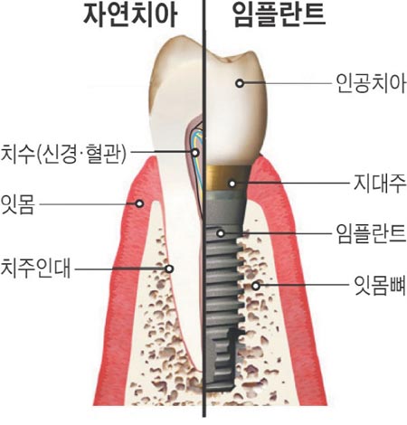 연세이웃치과 이미지