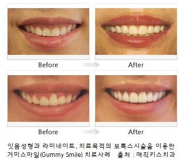 미소가아름다운치과 이미지