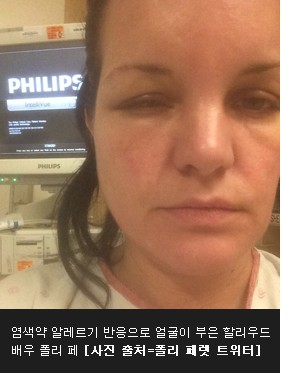 여우머리 이미지