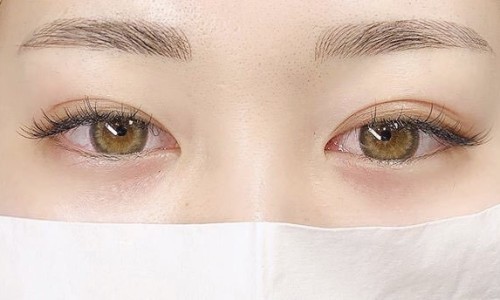 르네브로우 이미지