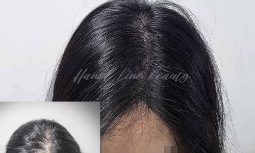 김포타투여명 이미지