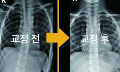 더바른교정재활센터 이미지