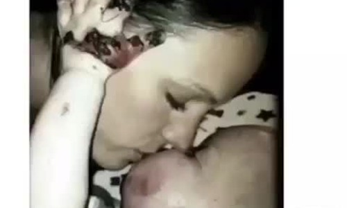 스킨스토리(story) 이미지