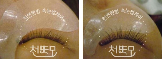 조은케어 이미지