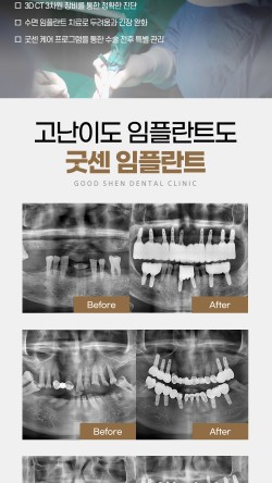 굿센치과의원 이미지
