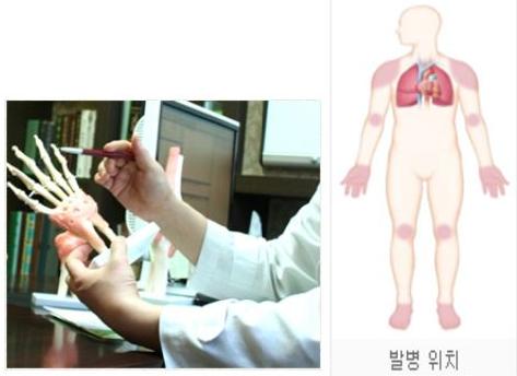 면역생활 이미지