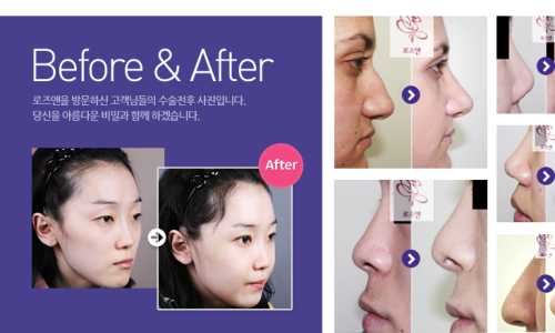 로즈앤성형외과의원 이미지