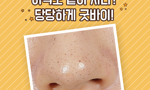 착한모공 이미지