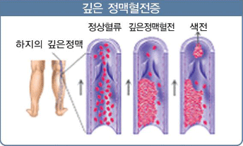 일산복음요양병원 이미지