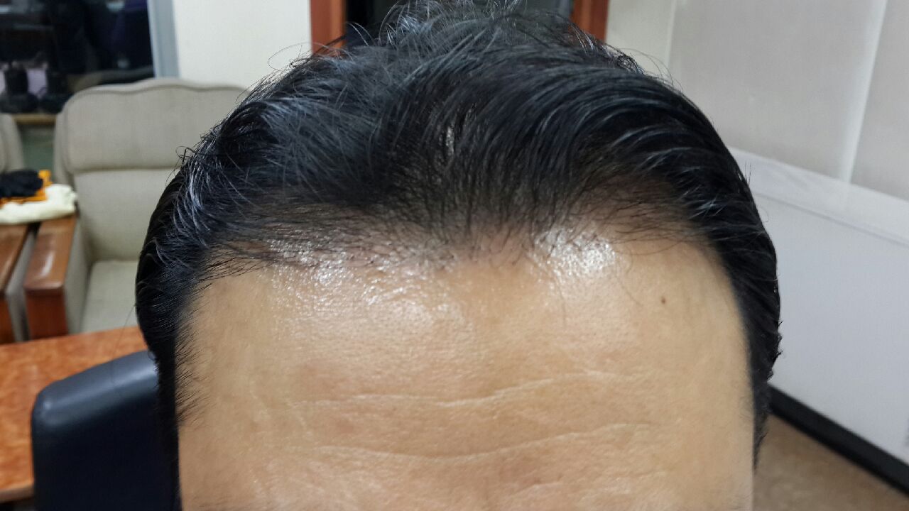 버르장머리 이미지