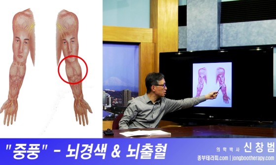 종부테라피 이미지