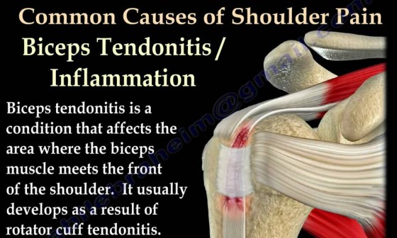 Examination Of The AC Joint - Everything You Need To Know - Dr. Nabil  Ebraheim 