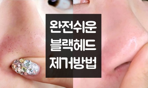 민CARE1 이미지