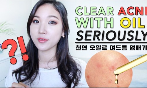 아이템허브 이미지