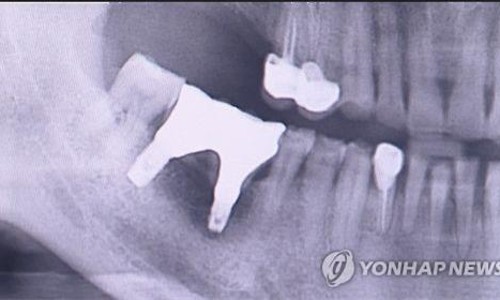 서울美치과 이미지