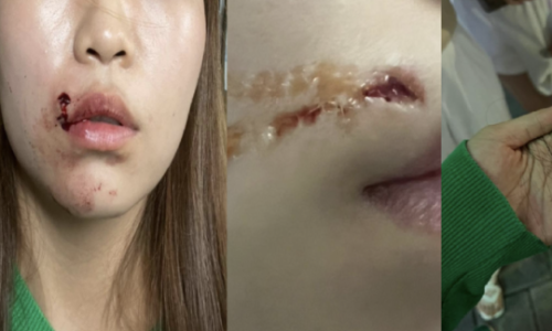 경기광주싱크대 이미지