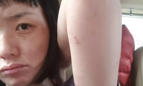 은혜반점 이미지