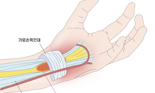 핑크마우스 이미지