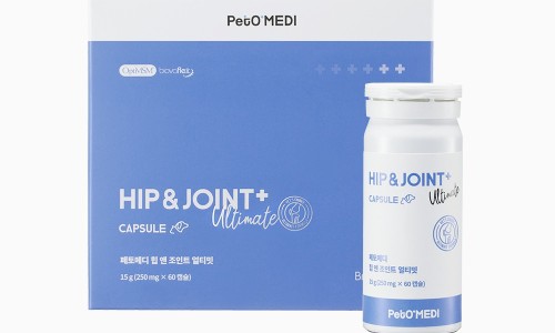 본앤조인트 이미지