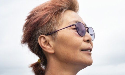 비마이너 이미지