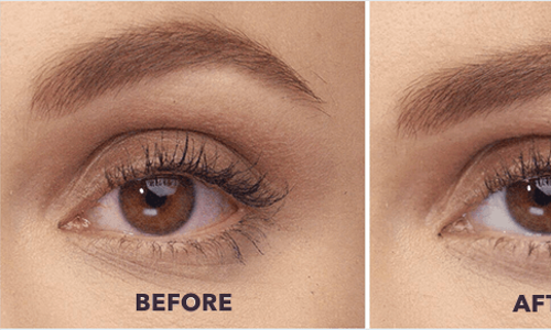 Refresh Liquigel Eye Gel for eye dryness Relief