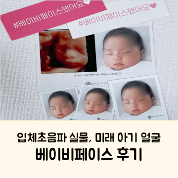 입체초음파 실물 2세 미래 아기 얼굴 비교, 베이비페이스 후기