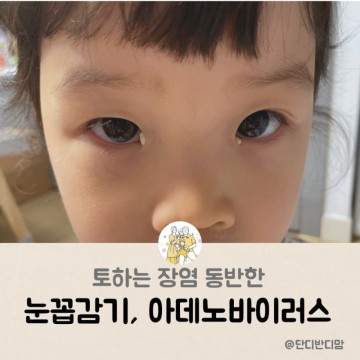토하는장염 유아장염 코감기 동반한 아기 눈꼽감기 아데노바이러스 증상