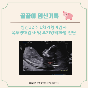 임신 12주 기형아검사 목투명대 및 니프티 조기양막파열 진단(꿀꿀이 임신일기)