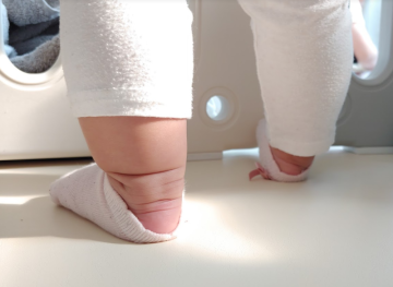 기저귀발진 땀띠 증상 아기 습진 관리