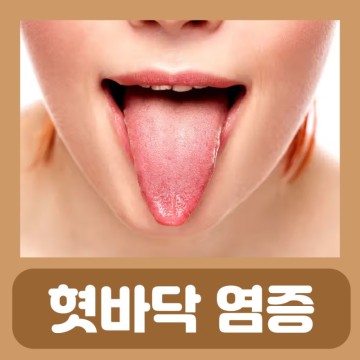 설염 빨리낫는법 치료 혓바닥 혀 갈라짐 염증 통증 따가움 피 딸기혀 색깔