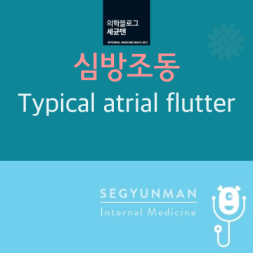 심방조동 : Typical atrial flutter (counterclockwise/clockwise circuit )