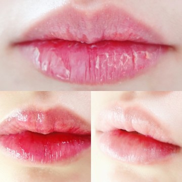 입술 뜯는 버릇 갈라짐 건조증 주름 껍질 립클렌징 및 관리법