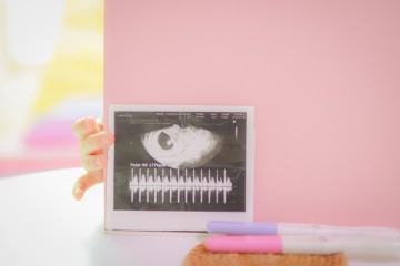 임신 극초기증상 냉, 아랫배통증, 피 +아기집 난황 확인 시기