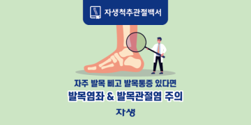 자주 발목 삐고 발목통증 있다면 발목염좌 & 발목관절염 주의