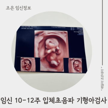 임신 10주 11주 12주 입체초음파 1차 기형아검사