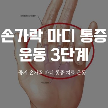 중지 손가락 마디 통증 치료 운동 3단계
