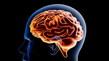 뇌졸증 뇌졸중 예방에 좋은 음식 진단 검사 방법은?