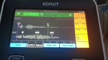 KOROT P3 Accurate 전문가용 혈압계 : 1개월 체험