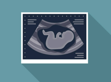 임신극초기증상 임신극초기 설사 임신극초기냉 임신초기약