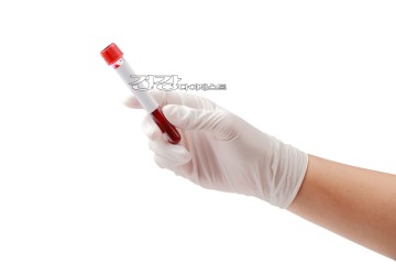 [만성 염증]  
혈액 검사로 알아보는 법 